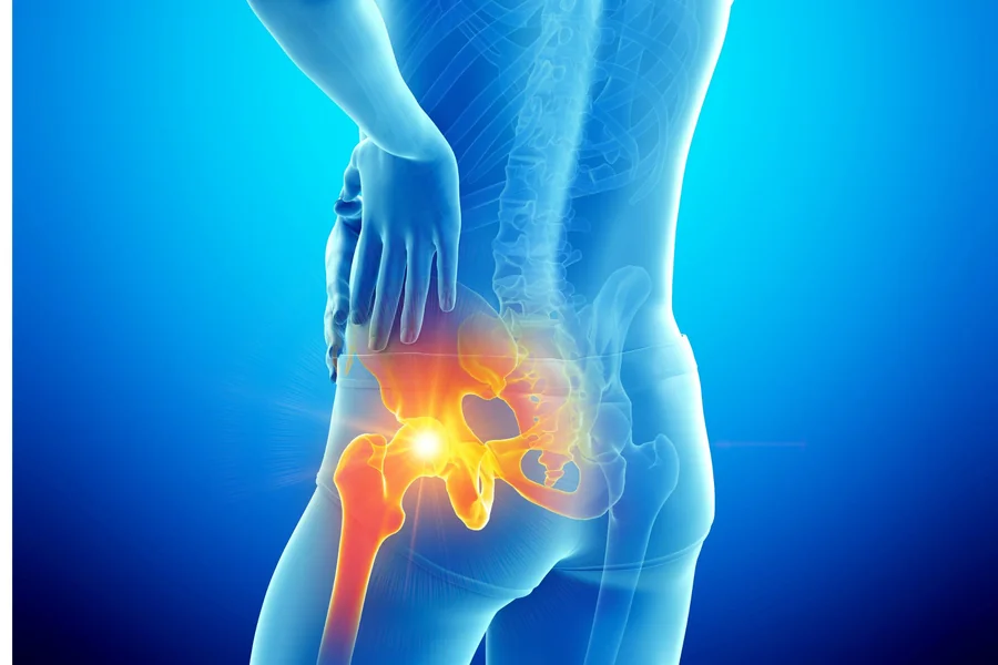 Understanding Long Term Solutions for Severe Hip Joint Pain
